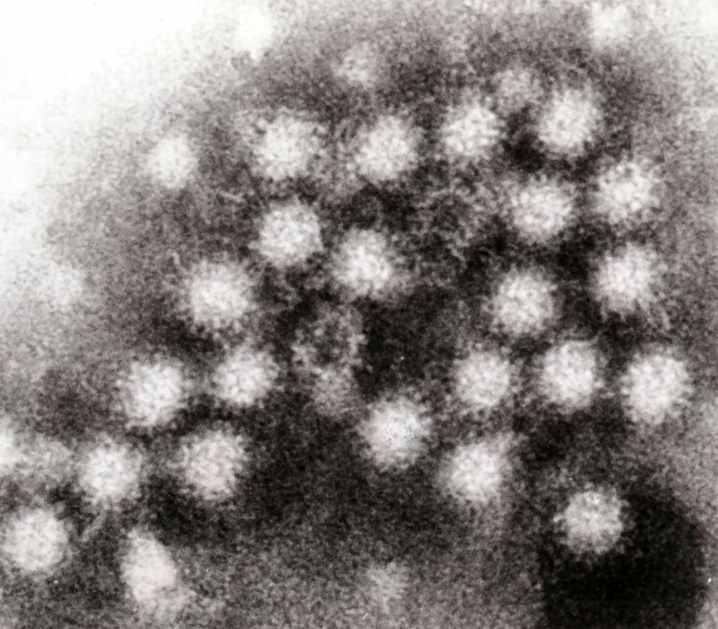 norovirus norovirus