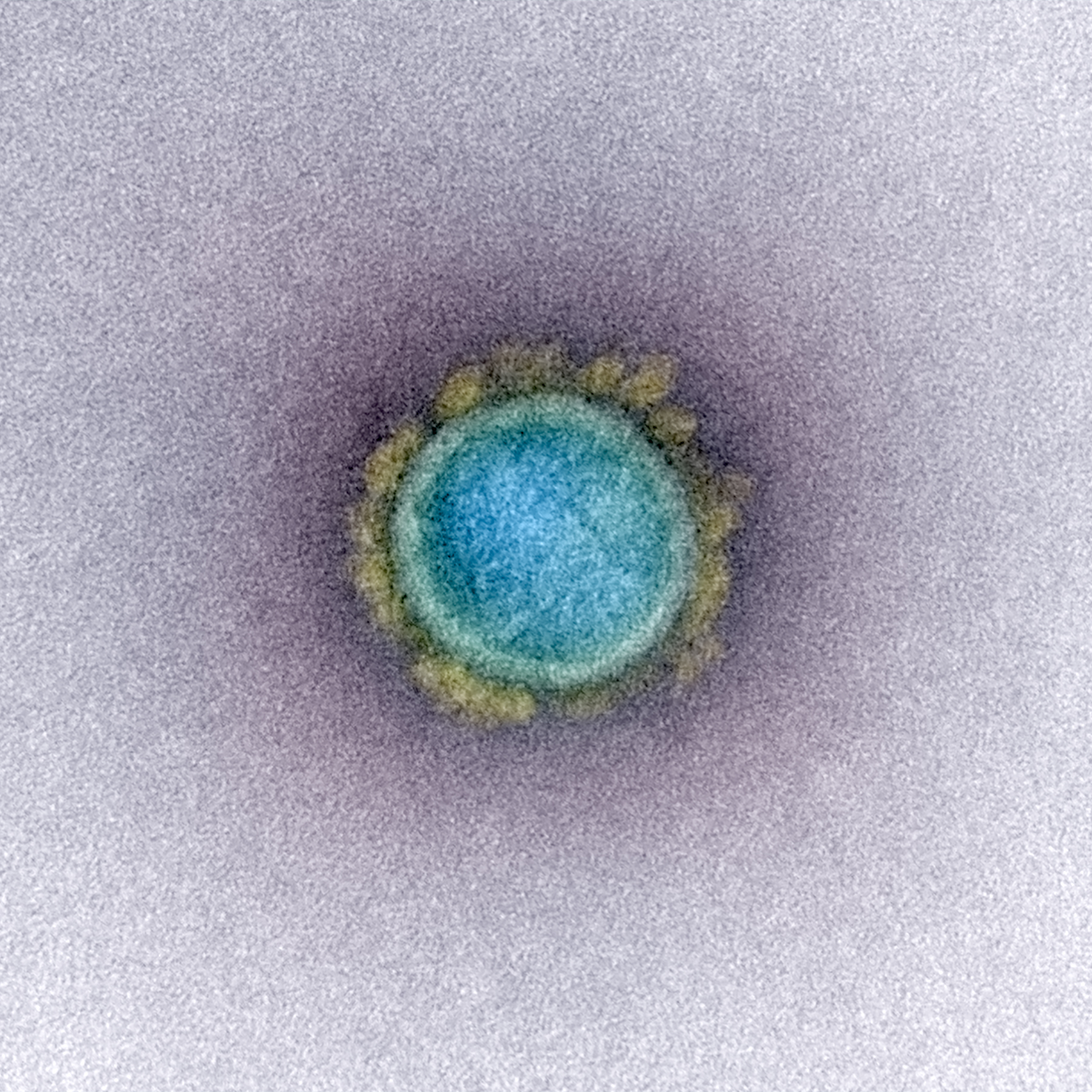 The SARS-CoV-2 virus