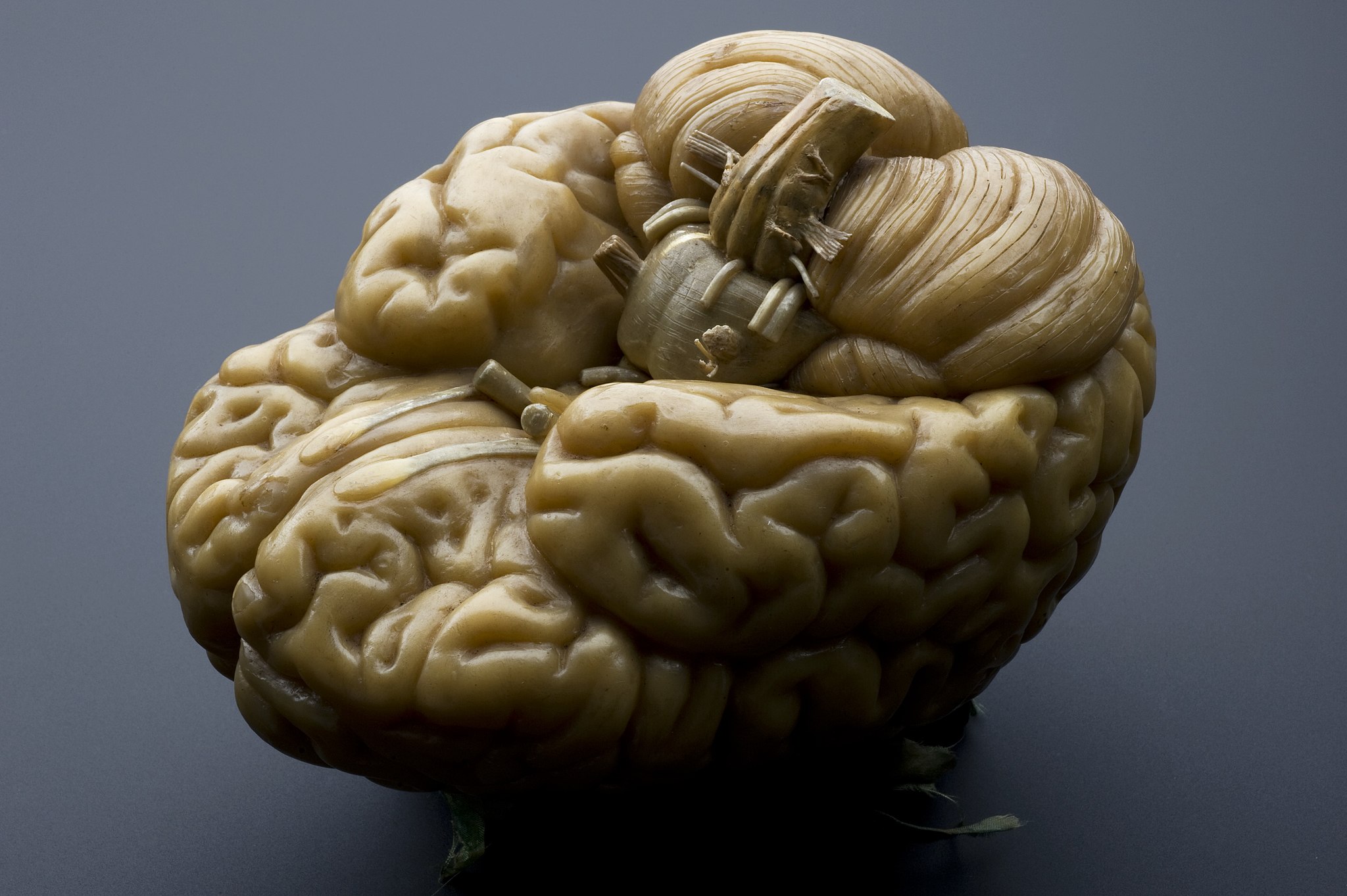 brain brain