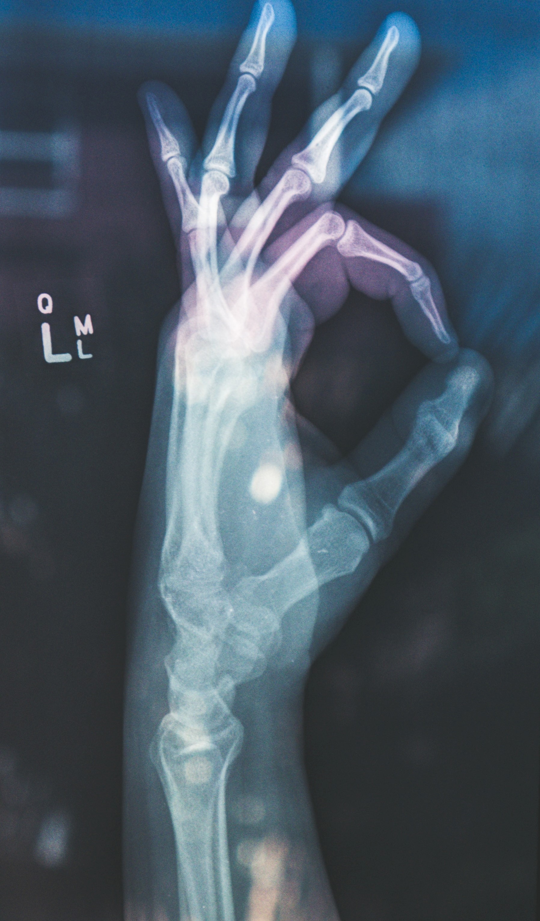 X-rayed hands showing the "OK" sign X-rayed hands showing the "OK" sign